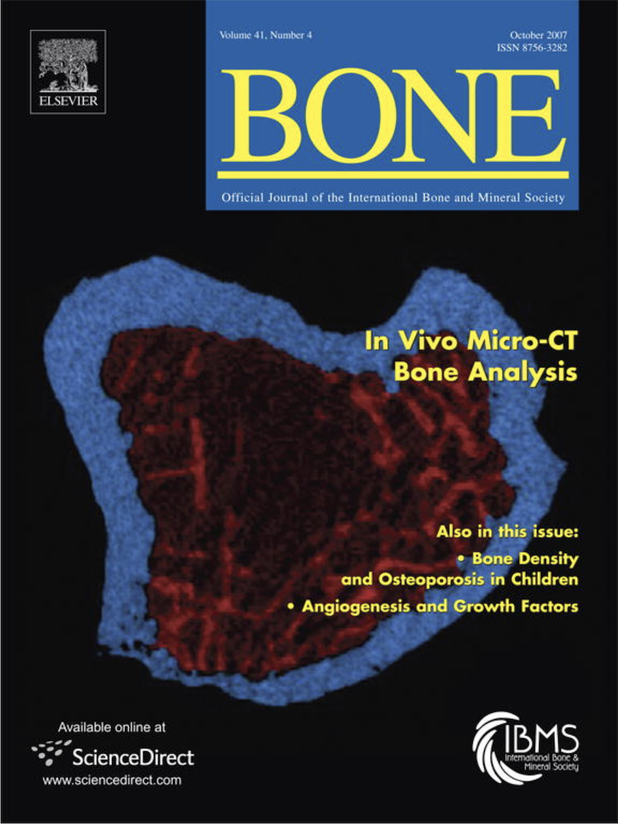 Our work on the cover of Bone