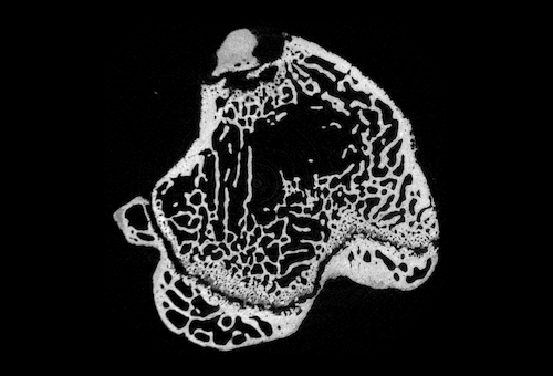 Tomographic Reconstruction