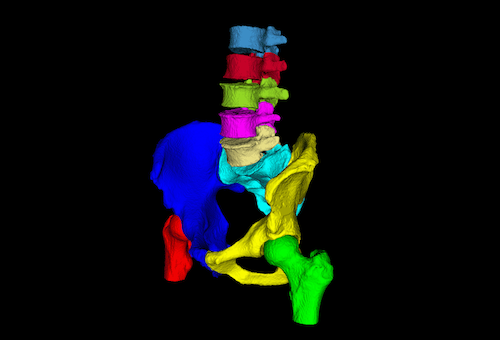 Opportunistic CT