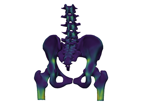 Cortical Bone Mapping